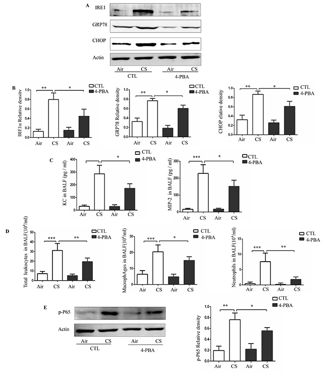 Effect of 4-PBA on CS-induced inflammation in mouse lungs.