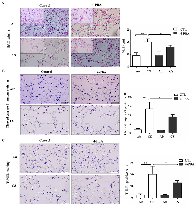 Effect of 4-PBA on CS-induced emphysema and alveolar cells apoptosis in mouse lungs.