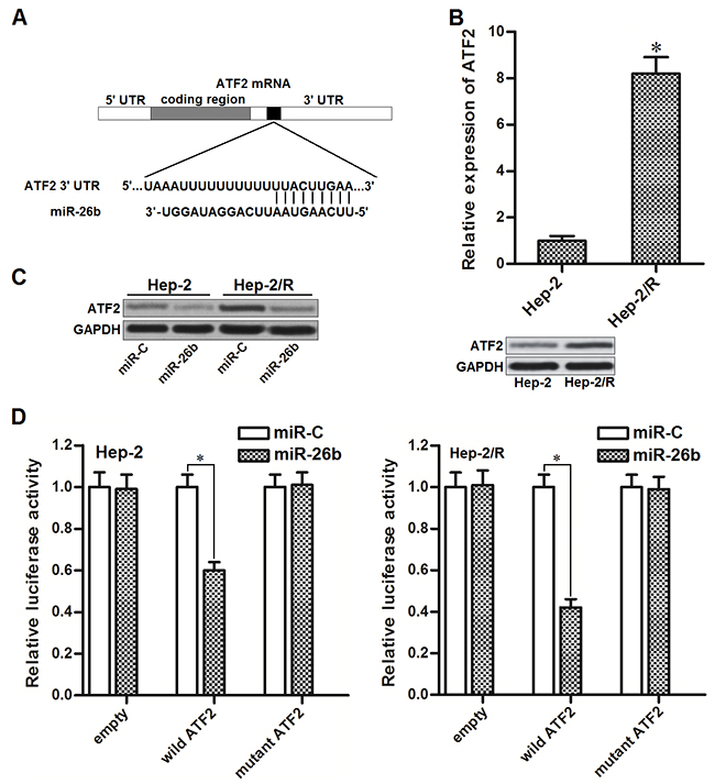 miR-26b targets ATF2 in Hep-2 and Hep-2/R.