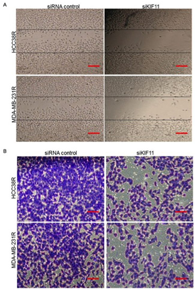 Knockdown of KIF11 inhibits migration and invasion of resistant TNBC cells.