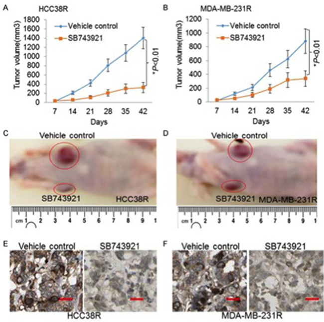 The KIF11 inhibitor induces significantly tumor regression in the docetaxel resistant TNBC xenograft models.