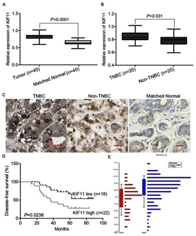 KIF11 is up-regulated in TNBC and associated with patients&#x2019; survival.