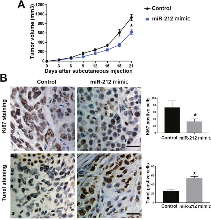 MiR-212 inhibited the in vivo growth of RCC cell in nude mice.