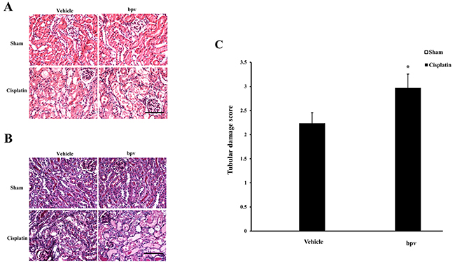 Inhibition of PTEN activity exacerbated cisplatin-induced AKI.