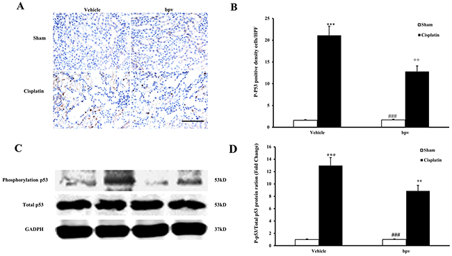 Inhibition of PTEN activity suppressed p53 phosphorylation in cisplatin-induced AKI.