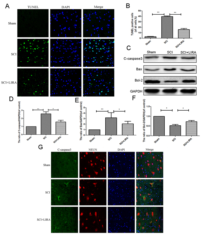 Liragutide reduces apoptosis caused by SCI in rats.