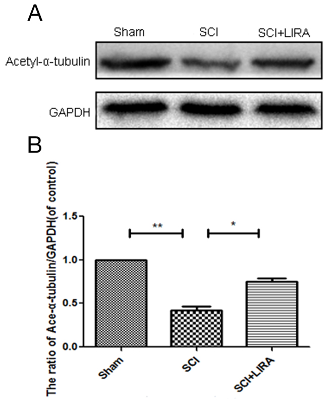 Liraglutide increase microtubule acetylation in acute SCI.