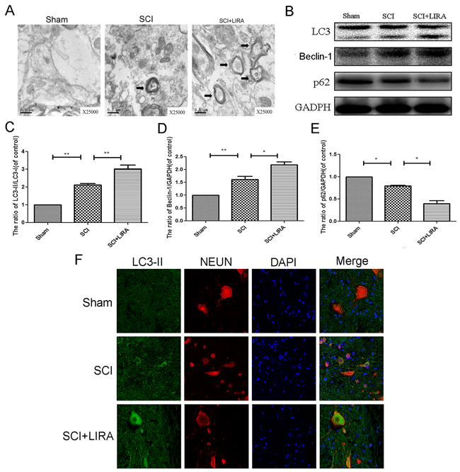 Liraglutide treatment promotes autophagy in rats of SCI.