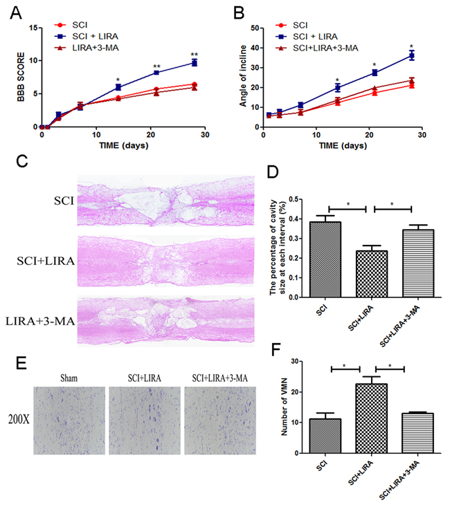 Inhibition of autophagy reversed functional recovery and tissue preservation of liraglutide treatment.