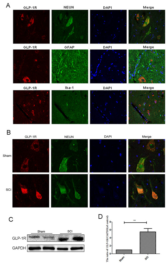 GLP-1R is mainly expressed in neuron in spinal cord tissue and significantly increases after acute SCI.