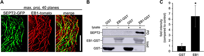 Septins interact with EB1 in cancer cells.
