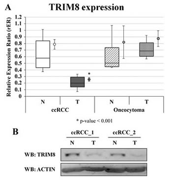 TRIM8 expression in renal cancer samples.