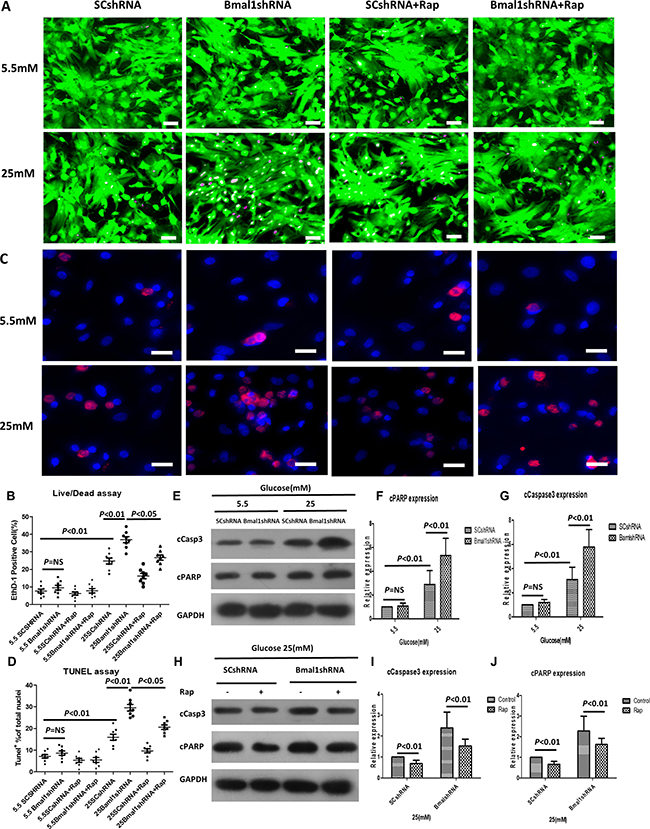 Knockdown of Bmal1 enhances high-glucose-induced cardiomyocyte death, whereas Rap treatment reverses this effect.