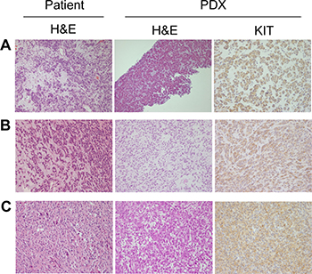 Immunohistochemical (IHC) analysis of original patient tumors and patient-derived xenograft (PDX) models.
