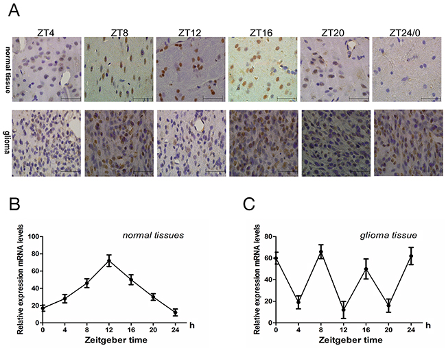 The rhythmic expression of Cry 2 mRNA and protein in the rat glioma model.