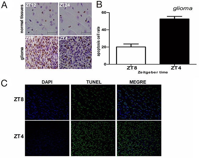 Cell proliferation and apoptosis in glioma and normal brain tissues after irradiation.
