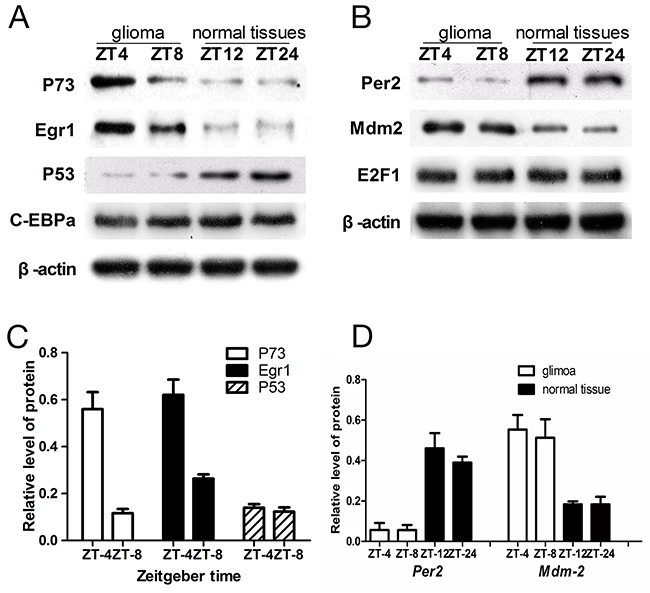Western blot analysis of p73, Egr1, p53, Per2, MDM2, C-EBP&#x03B1; and E2F1 in glioma and normal tissues.