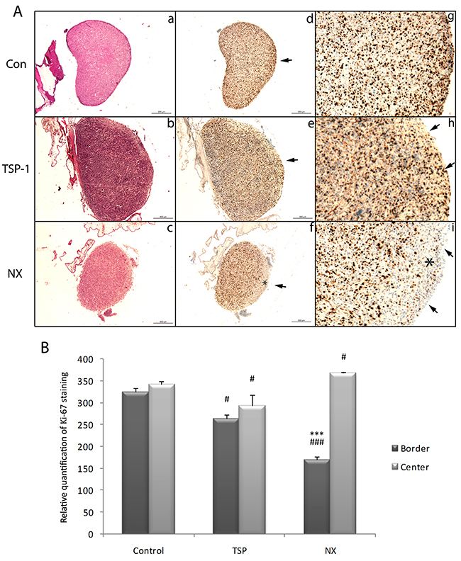 Histological and immunohistological analysis of proliferation in tumors from the CAM after treatments.