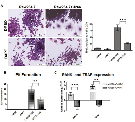 MM cells induce osteoclast differentiation in a Notch-dependent manner.