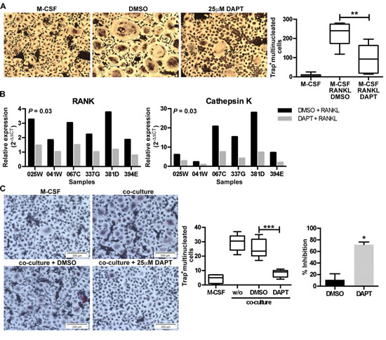 Inhibition of Notch signaling inhibits RANKL- and myeloma cell-induced osteoclastogenesis.