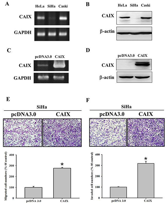 The mRNA and protein expressions of carbonic anhydrase IX (CAIX) in different cancer cell lines.