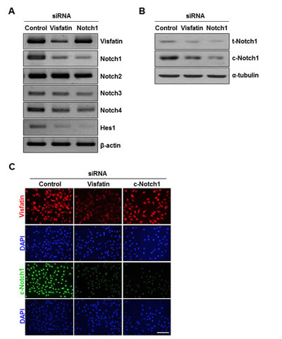 Effects of visfatin depletion on Notch1 expression.