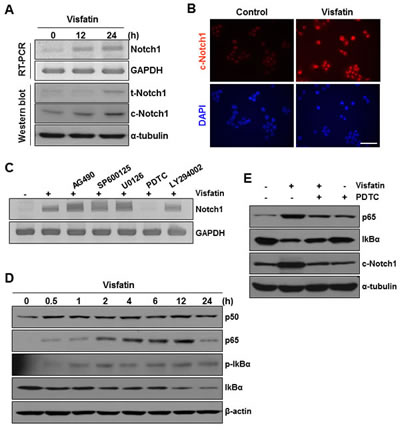 Effects of NF-&#x3ba;B signaling inhibition on visfatin-induced Notch1 upregulation and colony formation of breast cancer cells.