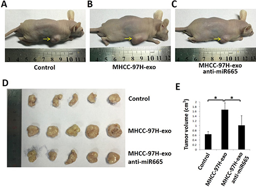 Exosomal miR-665 promoted xenograft tumour growth