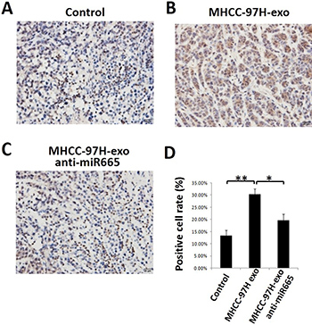 MHCC97H-exosome anti miR-665 downregulated the expression of P-ERK