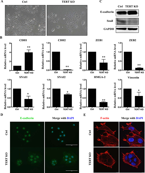 Knock-out hTERT inhibits EMT in SCC-15 cells.