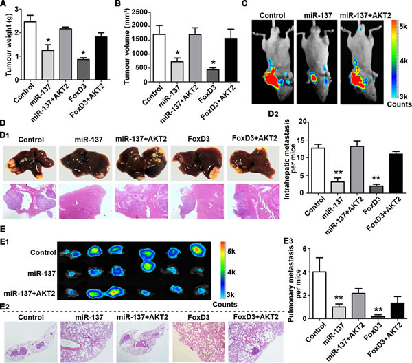 miR-137 inhibits HCC growth and metastasis via targeting AKT2