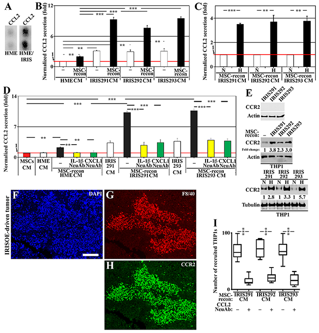 IRISOE cells entrained by MSCs recruit and activate TAMs.