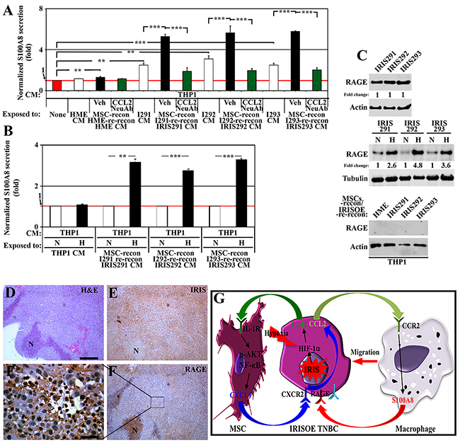 TAMs respond by secreting S100A8/9 to re-activate IRISOE TNBC cells.