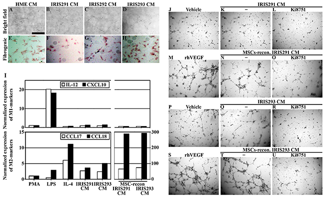 IRISOE TNBC tumor cells activate the microenvironment in vitro.