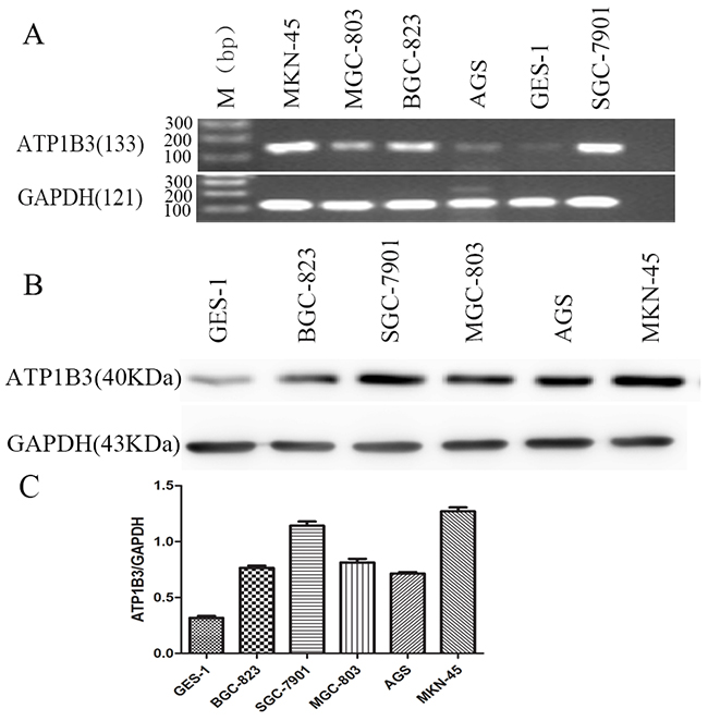 ATP1B3 mRNA and protein levels in gastric cancer cell lines.
