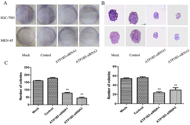 The effect of ATP1B3 silencing on the colony-formation ability of gastric cancer cells.