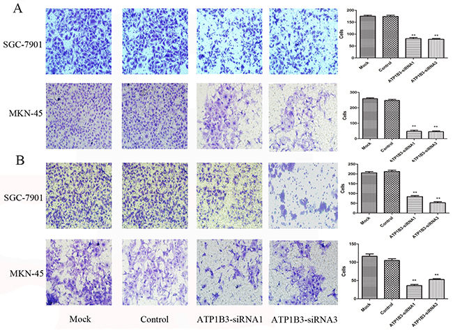 The effect of the knockdown of ATP1B3 expression on the migration and invasiveness of gastric cancer SGC-7901 and MKN-45 cells.