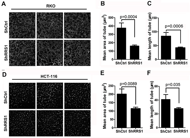 Knockdown of RRS1 represses colon cancer cell angiogenesis.