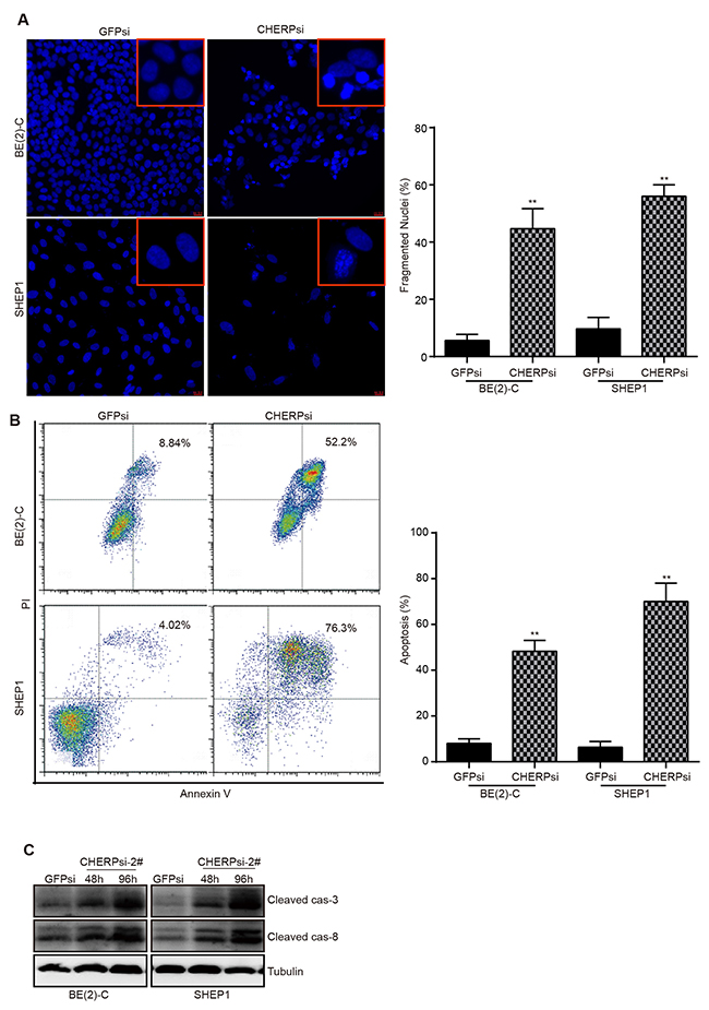 CHERP depletion induces neuroblastoma cells apoptosis.