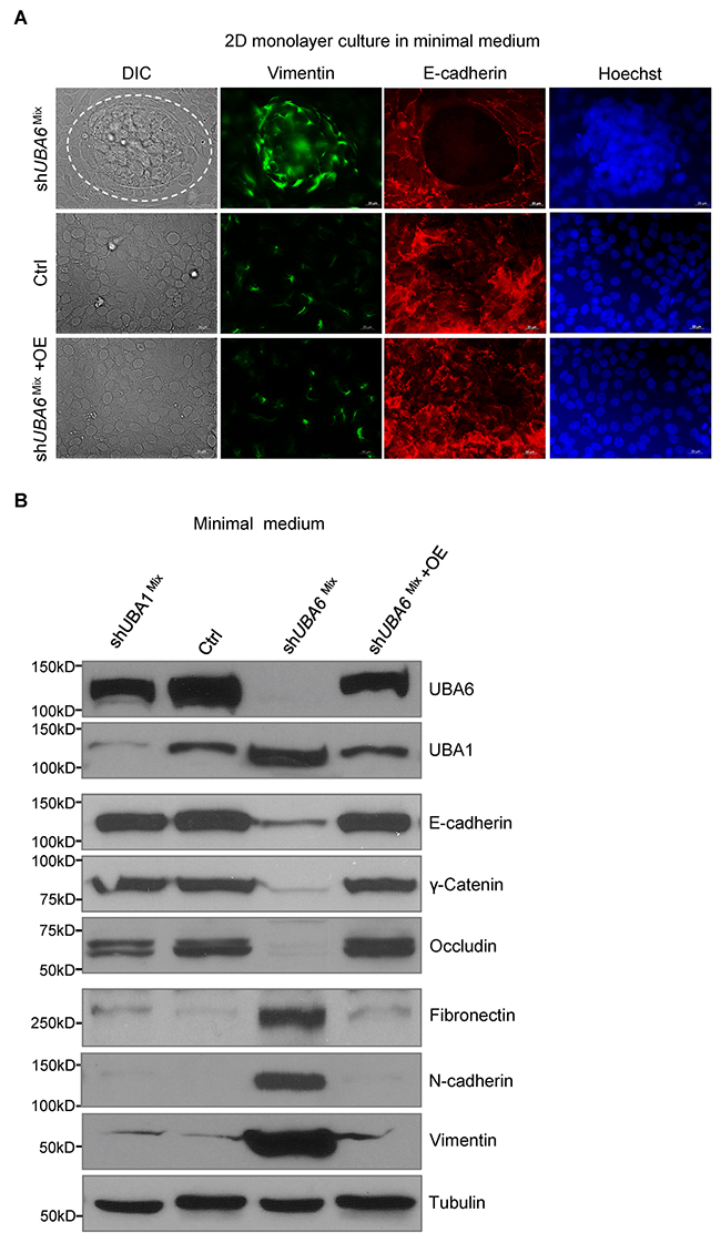 Growth factor deprivation induces EMT in shUBA6Mix MCF10A cells.