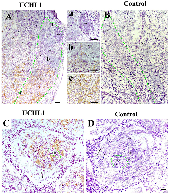 Localization of UCHL1 in male gonads of adult CGS by IHC.