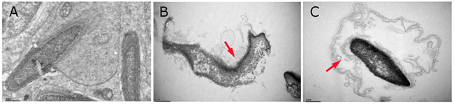 Ultrastructure of sperm in male mice after the administration of MEQ for 18 months (scale bar = 1 &#x03BC;m).