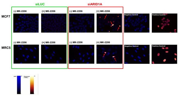 Treatment with the AKT-inhibitor MK-2206 causes apoptosis in ARID1A-depleted MCF7 and MRC5 cells.