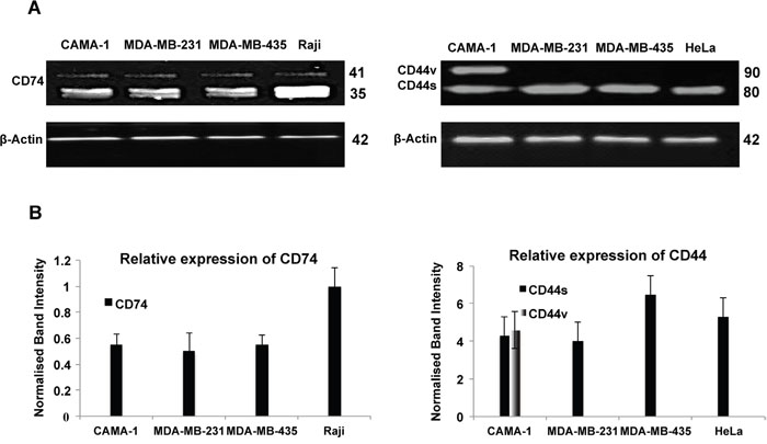 Western blot analysis of CD74, CD44 and &#x03B2;-actin expression in the CAMA-1, MDA-MB-231, MDA-MB-435 and Raji cells.