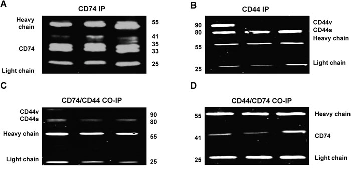 Co-immunoprecipitation (Co-IP) to study the interaction of CD74 and CD44 in CAMA-1, MDA-MB-231 and MDA-MB-435 cell lines.