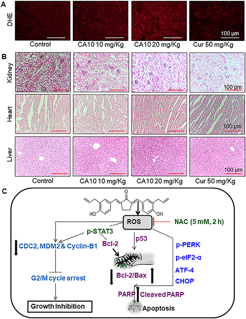 CA10 inhibits gastric cancer tumor xenograft growth by increasing ROS.