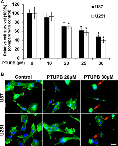 PTUPB inhibits cell proliferation and disrupts actin stress fibers.