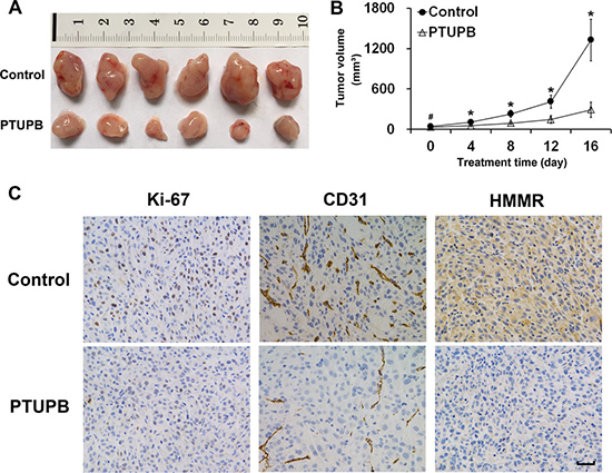 PTUPB suppresses glioblastoma growth in vivo.