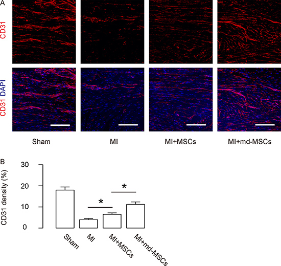 Enhanced angiogenesis is detected in MI-mice by transplantation of md-MSCs than MSCs.