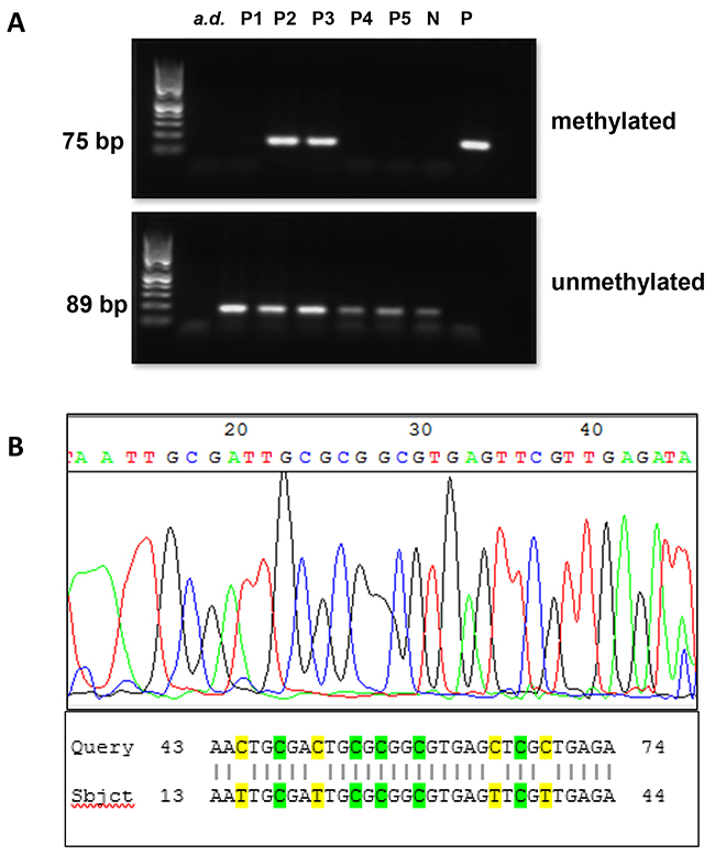 Analysis of BRCA1 promoter methylation status by MS-PCR and sanger sequencing.